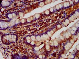 IHC image of CSB-PA007087LA01HU diluted at 1:600 and staining in paraffin-embedded human small intestine tissue performed on a Leica BondTM system. After dewaxing and hydration, antigen retrieval was mediated by high pressure in a citrate buffer (pH 6.0). Section was blocked with 10% normal goat serum 30min at RT. Then primary antibody (1% BSA) was incubated at 4°C overnight. The primary is detected by a biotinylated secondary antibody and visualized using an HRP conjugated SP system.