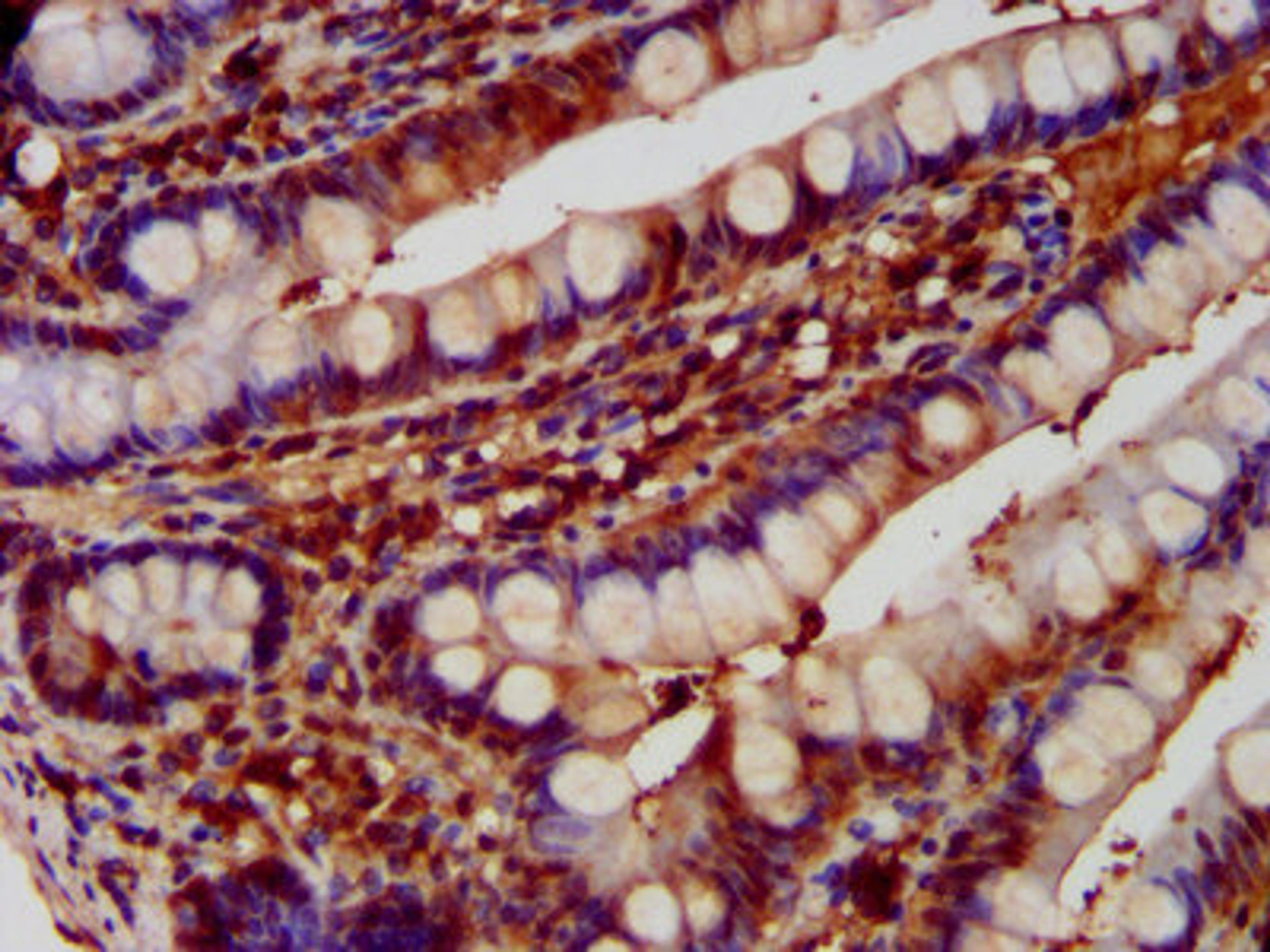 IHC image of CSB-PA007087LA01HU diluted at 1:600 and staining in paraffin-embedded human small intestine tissue performed on a Leica BondTM system. After dewaxing and hydration, antigen retrieval was mediated by high pressure in a citrate buffer (pH 6.0). Section was blocked with 10% normal goat serum 30min at RT. Then primary antibody (1% BSA) was incubated at 4°C overnight. The primary is detected by a biotinylated secondary antibody and visualized using an HRP conjugated SP system.