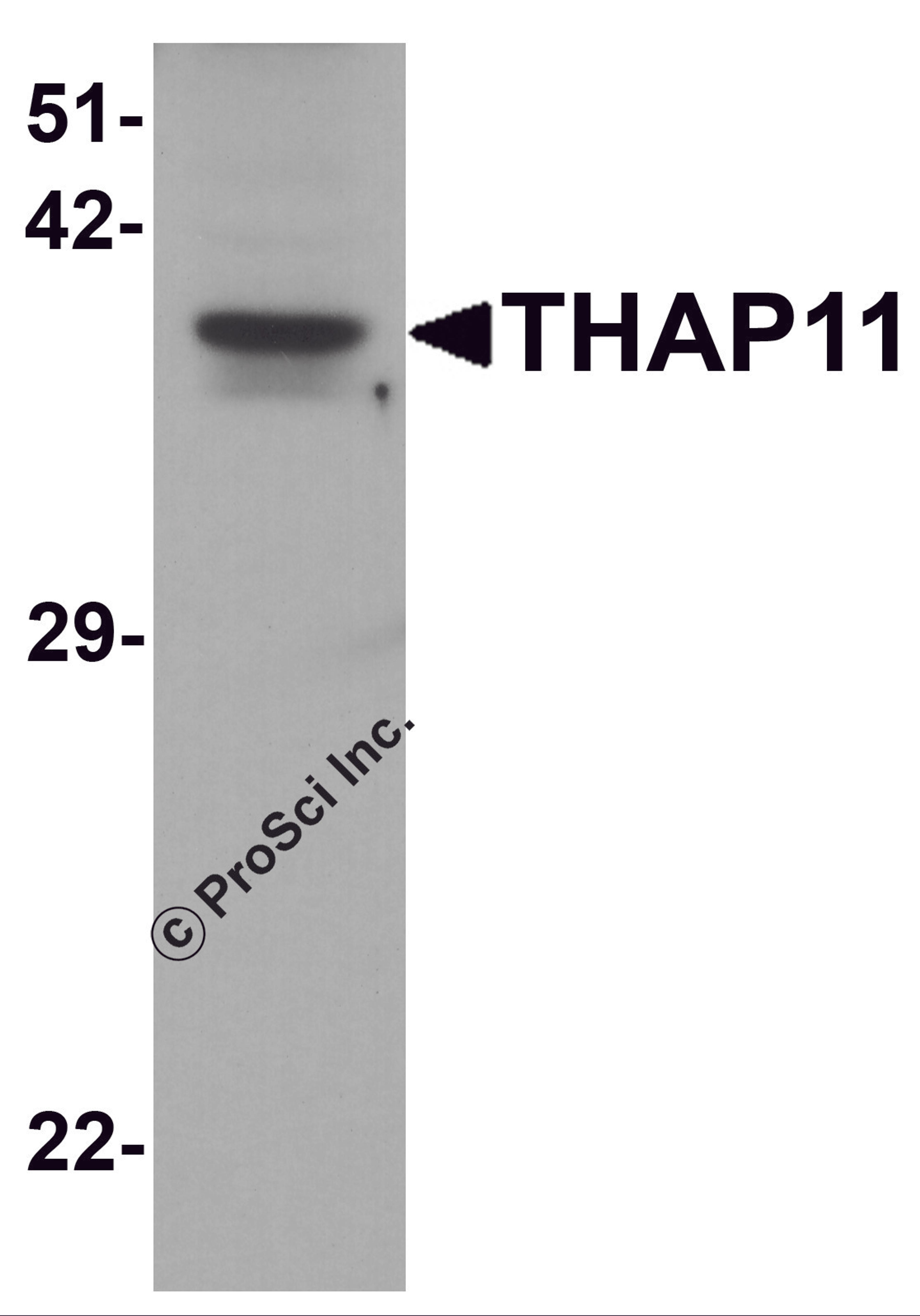 Western blot analysis of THAP11 in human brain tissue lysate with THAP11 antibody at 1 &#956;g/ml.