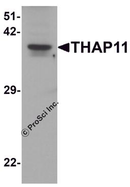 Western blot analysis of THAP11 in human brain tissue lysate with THAP11 antibody at 1 μg/ml.