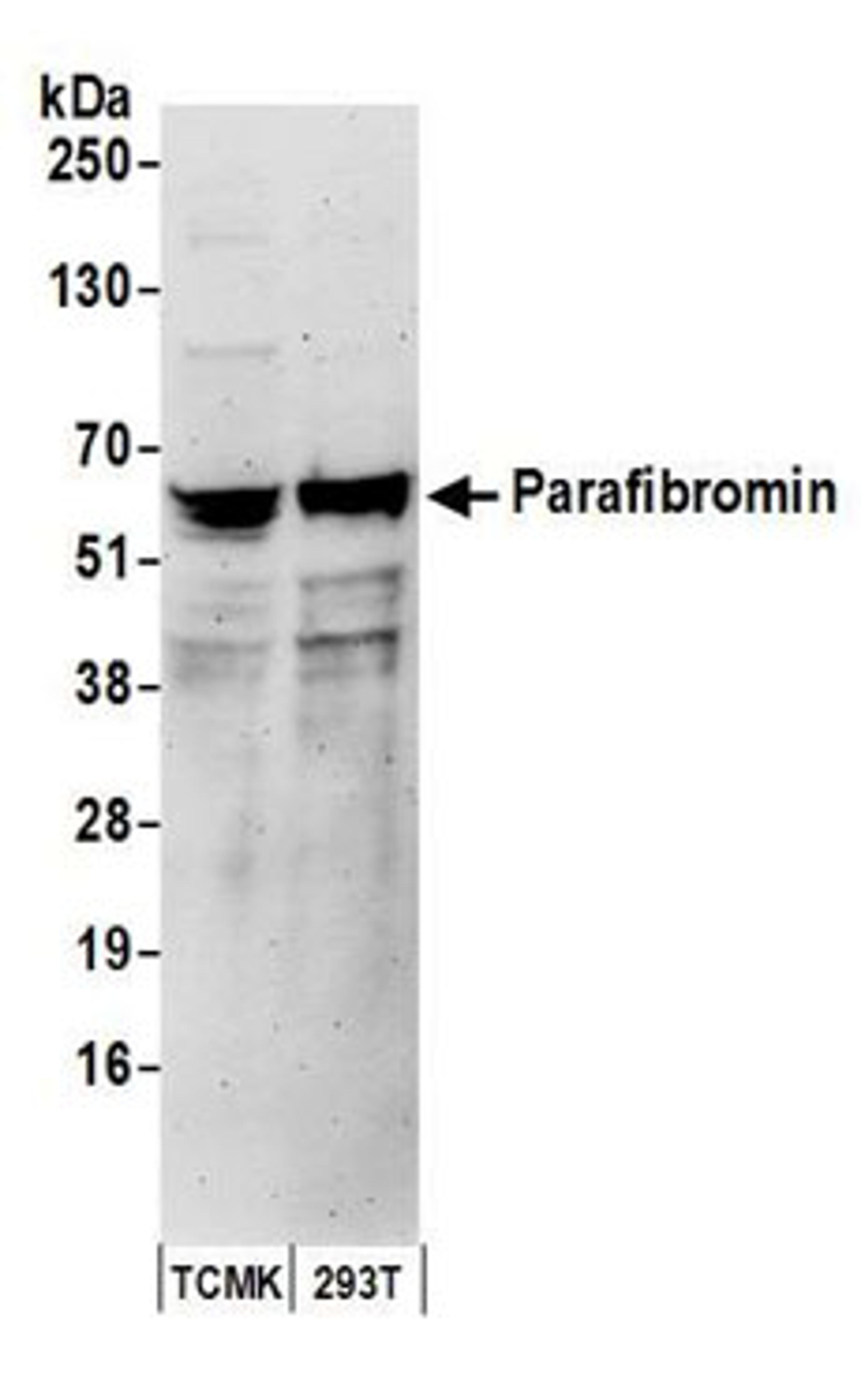 Detection of human and mouse Para fibromin by western blot.