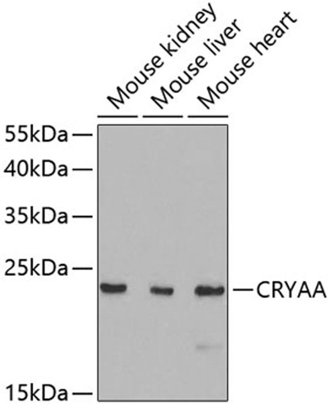 Western blot - CRYAA antibody (A5725)