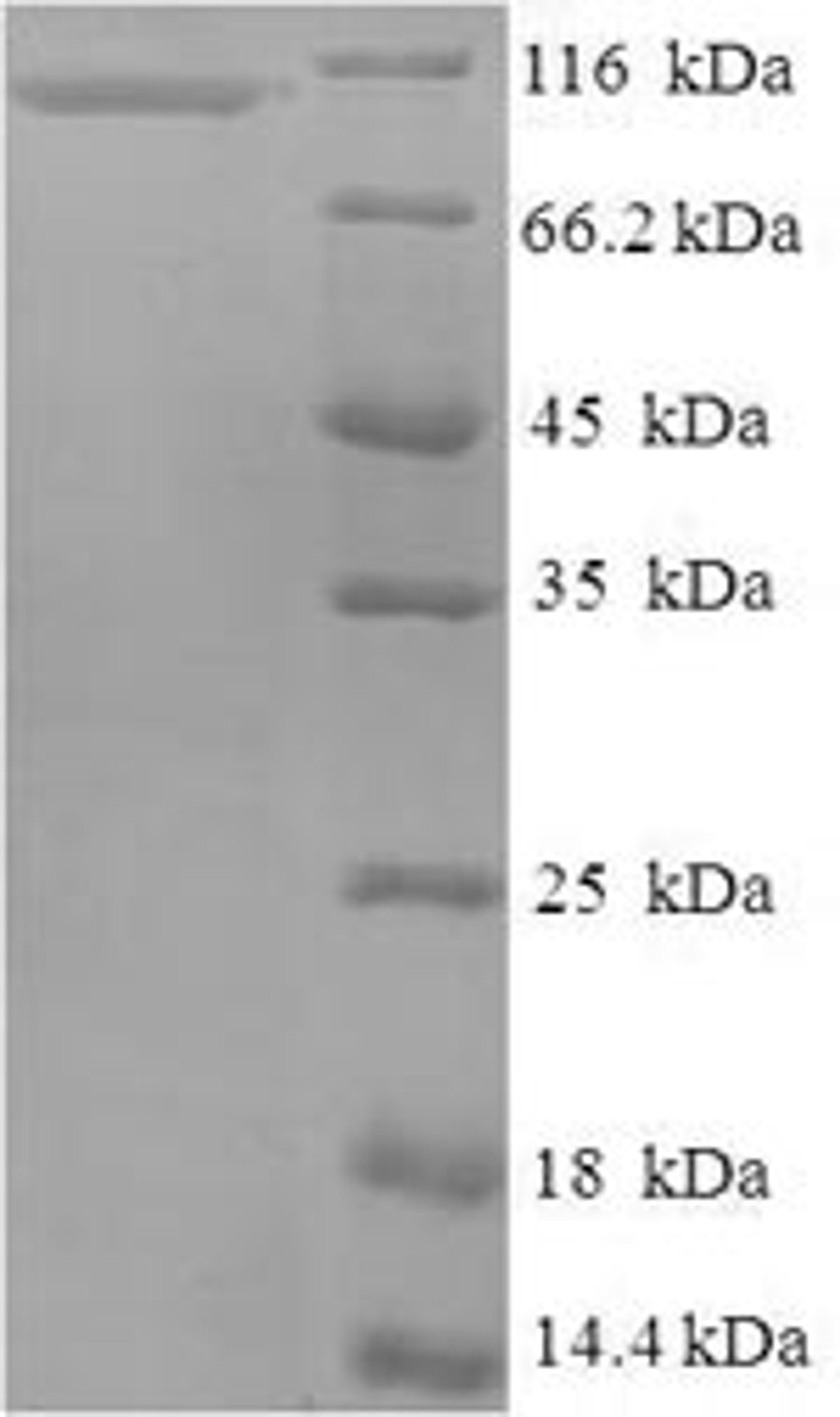 (Tris-Glycine gel) Discontinuous SDS-PAGE (reduced) with 5% enrichment gel and 15% separation gel.