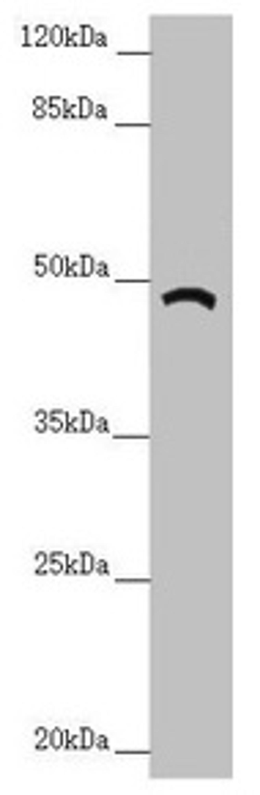 Western blot. All lanes: TRIM31 antibody at 6.18µg/ml + A549 whole cell lysate. Secondary. Goat polyclonal to rabbit IgG at 1/10000 dilution. Predicted band size: 49, 31 kDa. Observed band size: 49 kDa