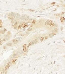 Detection of human Pygo1 by immunohistochemistry.