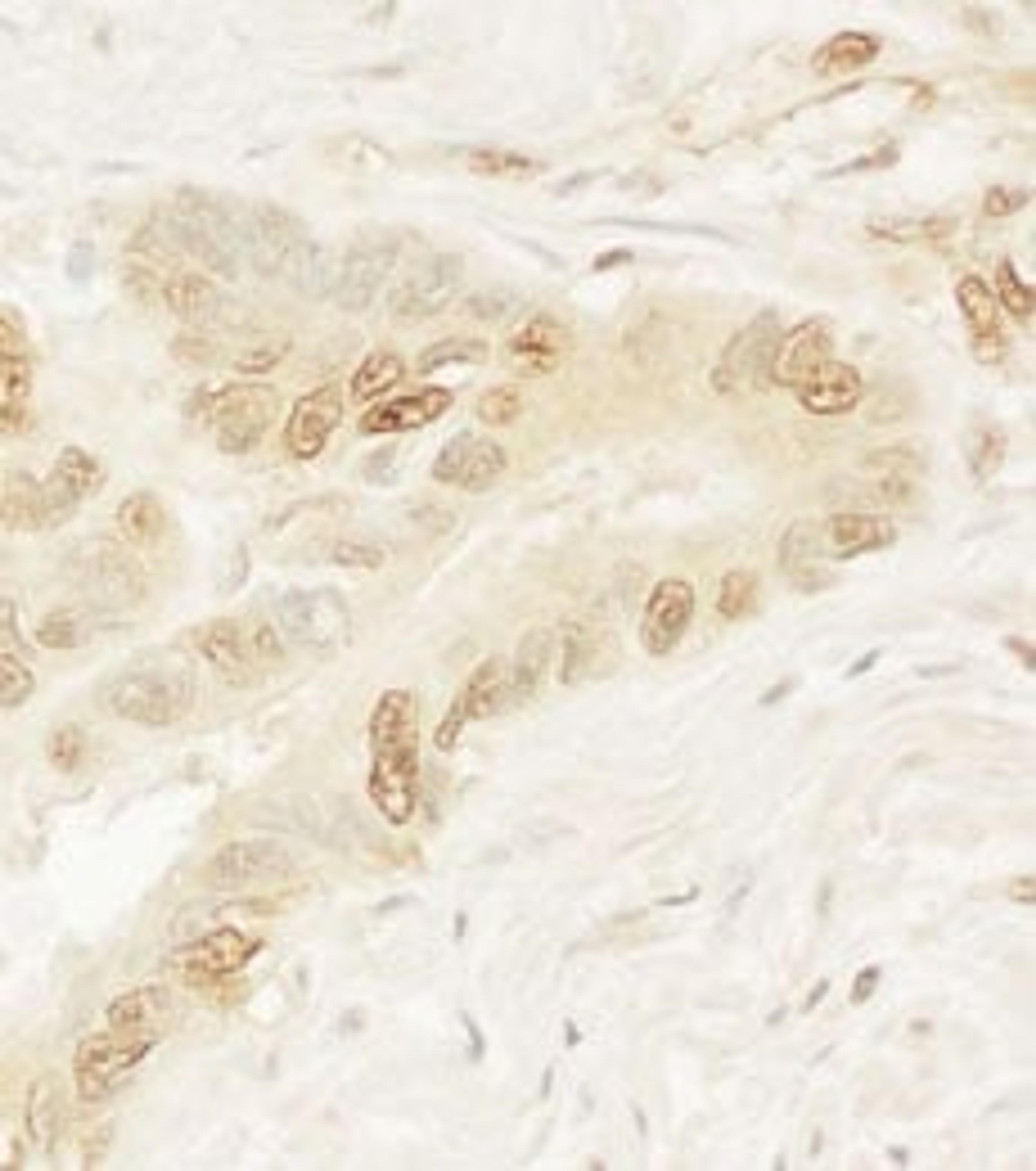 Detection of human Pygo1 by immunohistochemistry.