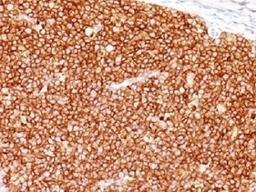 IHC testing of FFPE human tonsil with CD10 antibody (clone MME/1698). Required HEIR: boil tissue sections in 10mM Tris with 1mM EDTA, pH 9, for 10-20 min.