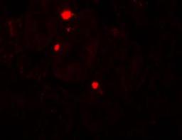 Immunocytochemistry/Immunofluorescence: ATG14 Antibody [NBP2-36445] - Immunofluorescence of ATG14 in human small intestine tissue with ATG14 antibody at 20 ug/mL.