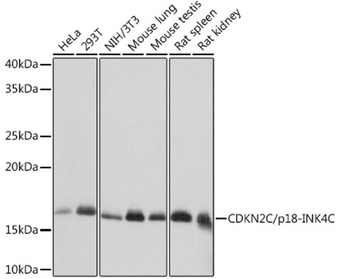 Western blot - CDKN2C/p18-INK4C Rabbit mAb (A8751)