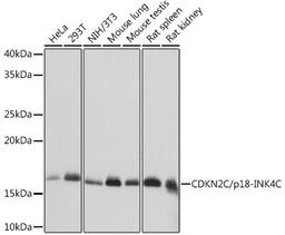 Western blot - CDKN2C/p18-INK4C Rabbit mAb (A8751)