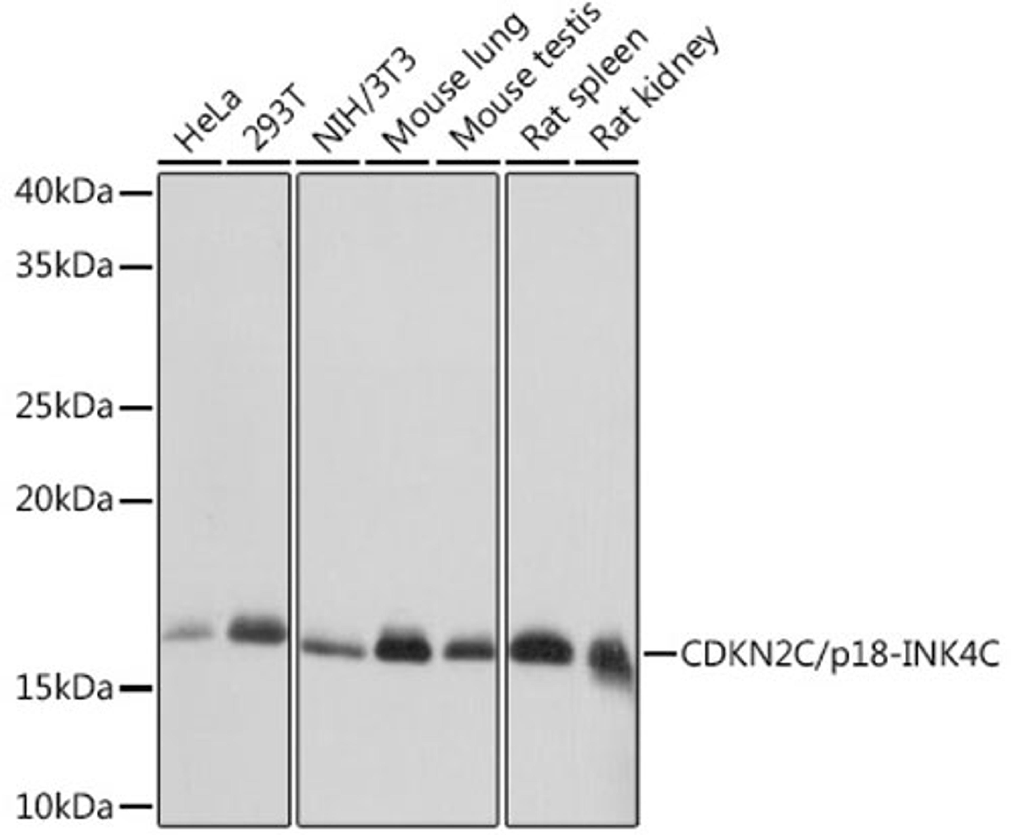 Western blot - CDKN2C/p18-INK4C Rabbit mAb (A8751)