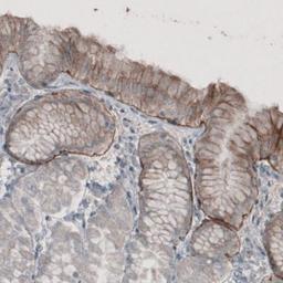 Immunohistochemistry: Laminin alpha 3 Antibody (CL3112) [NBP2-42390] - Staining of human stomach shows moderate immunoreactivity in basement membrane of glandular epithelium.