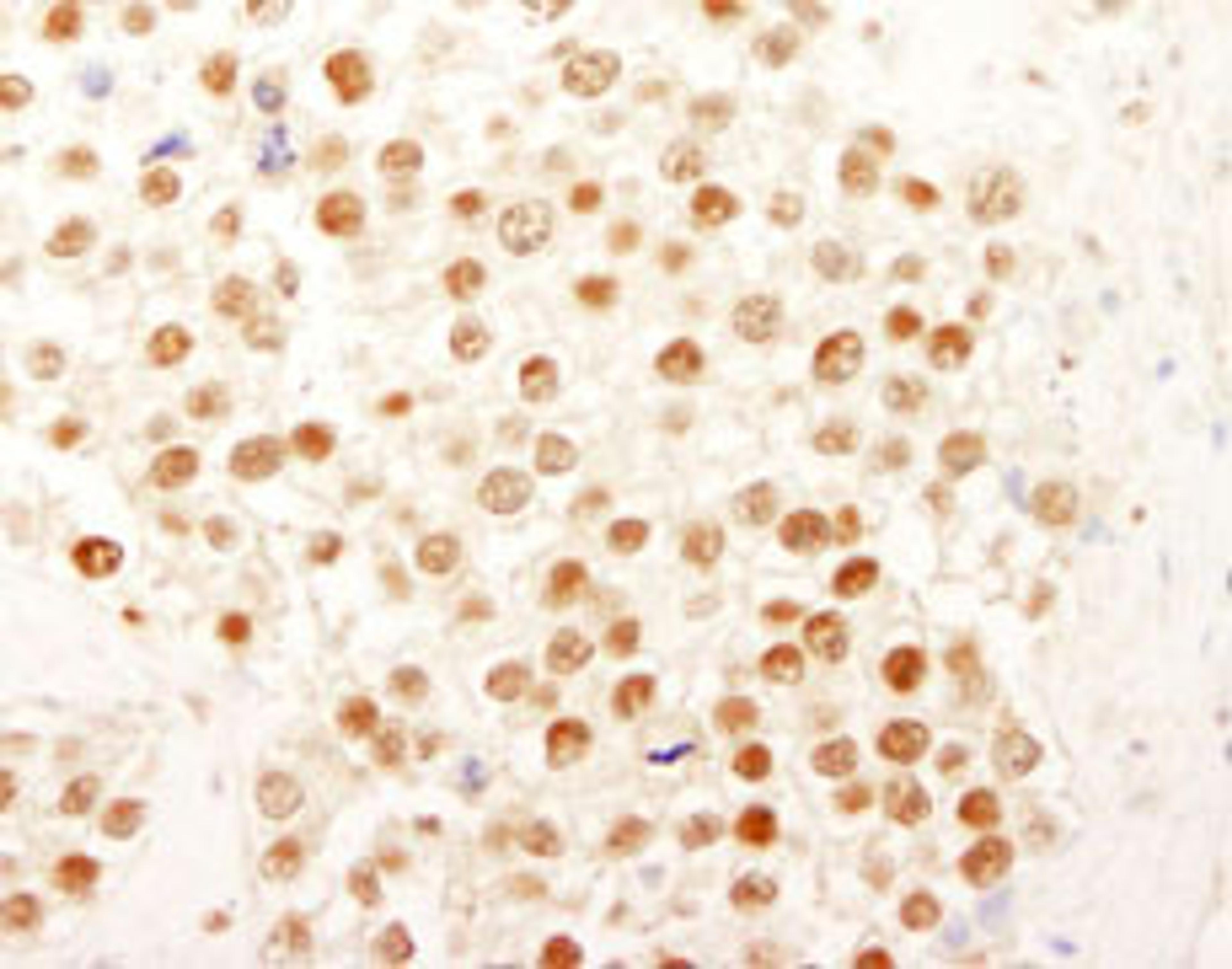 Detection of human NF-YC by immunohistochemistry.