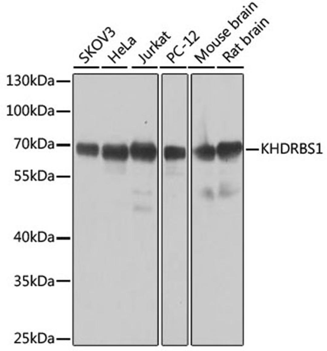 Western blot - KHDRBS1 antibody (A6101)