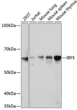 Western blot - IRF5 Rabbit mAb (A11106)