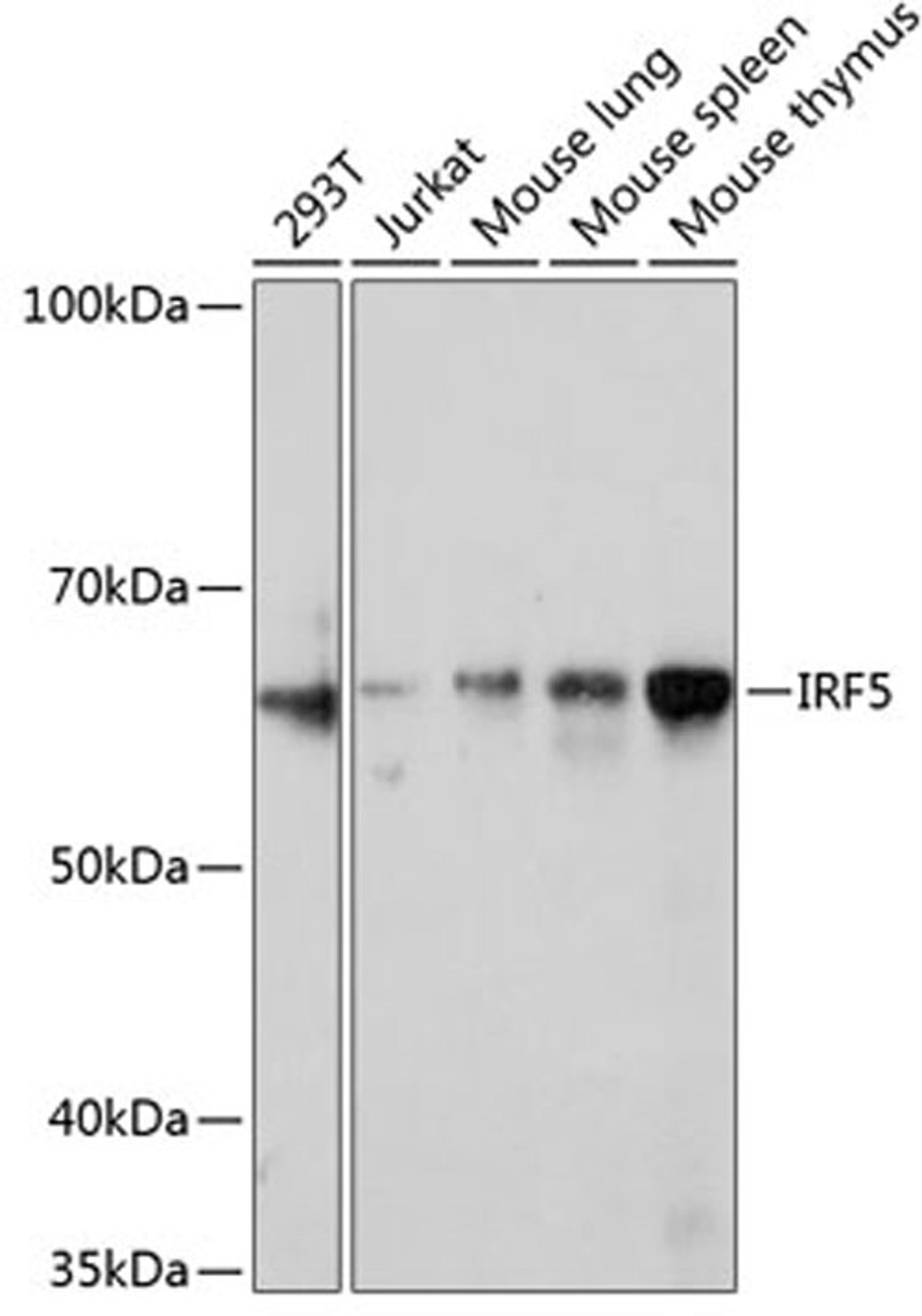 Western blot - IRF5 Rabbit mAb (A11106)