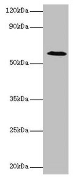 Western blot. All lanes: UGP2 antibody at 2µg/ml + Mouse liver tissue. Secondary. Goat polyclonal to rabbit IgG at 1/10000 dilution. Predicted band size: 57, 56 kDa. Observed band size: 57 kDa