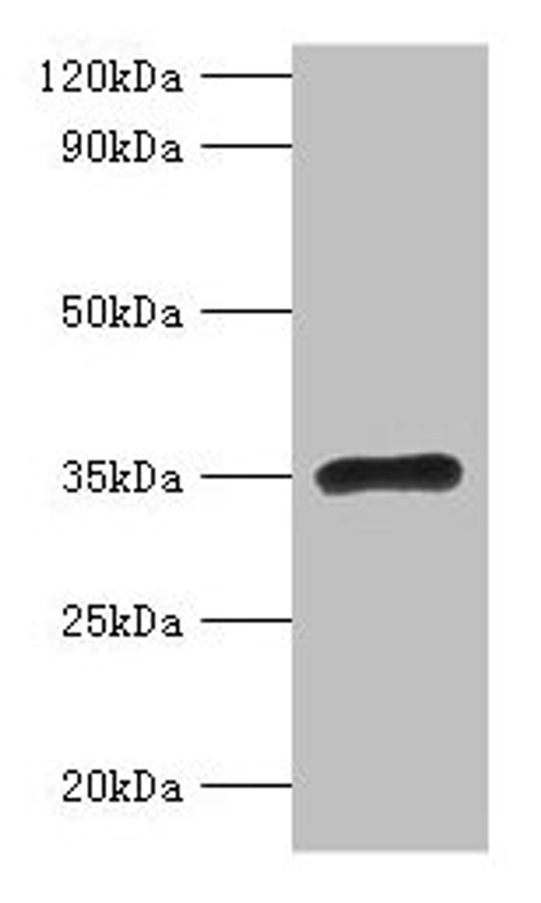 Western blot. All lanes: RPL5 antibody at 2µg/ml + EC109 whole cell lysate. Secondary. Goat polyclonal to rabbit IgG at 1/15000 dilution. Predicted band size: 35 kDa. Observed band size: 35 kDa