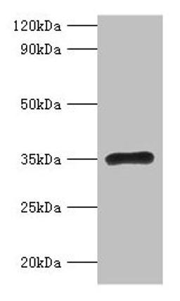 Western blot. All lanes: RPL5 antibody at 2µg/ml + EC109 whole cell lysate. Secondary. Goat polyclonal to rabbit IgG at 1/15000 dilution. Predicted band size: 35 kDa. Observed band size: 35 kDa