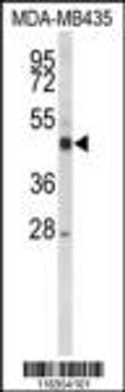 Western blot analysis of CYP21A2 Antibody in MDA-MB435 cell line lysates (35ug/lane)