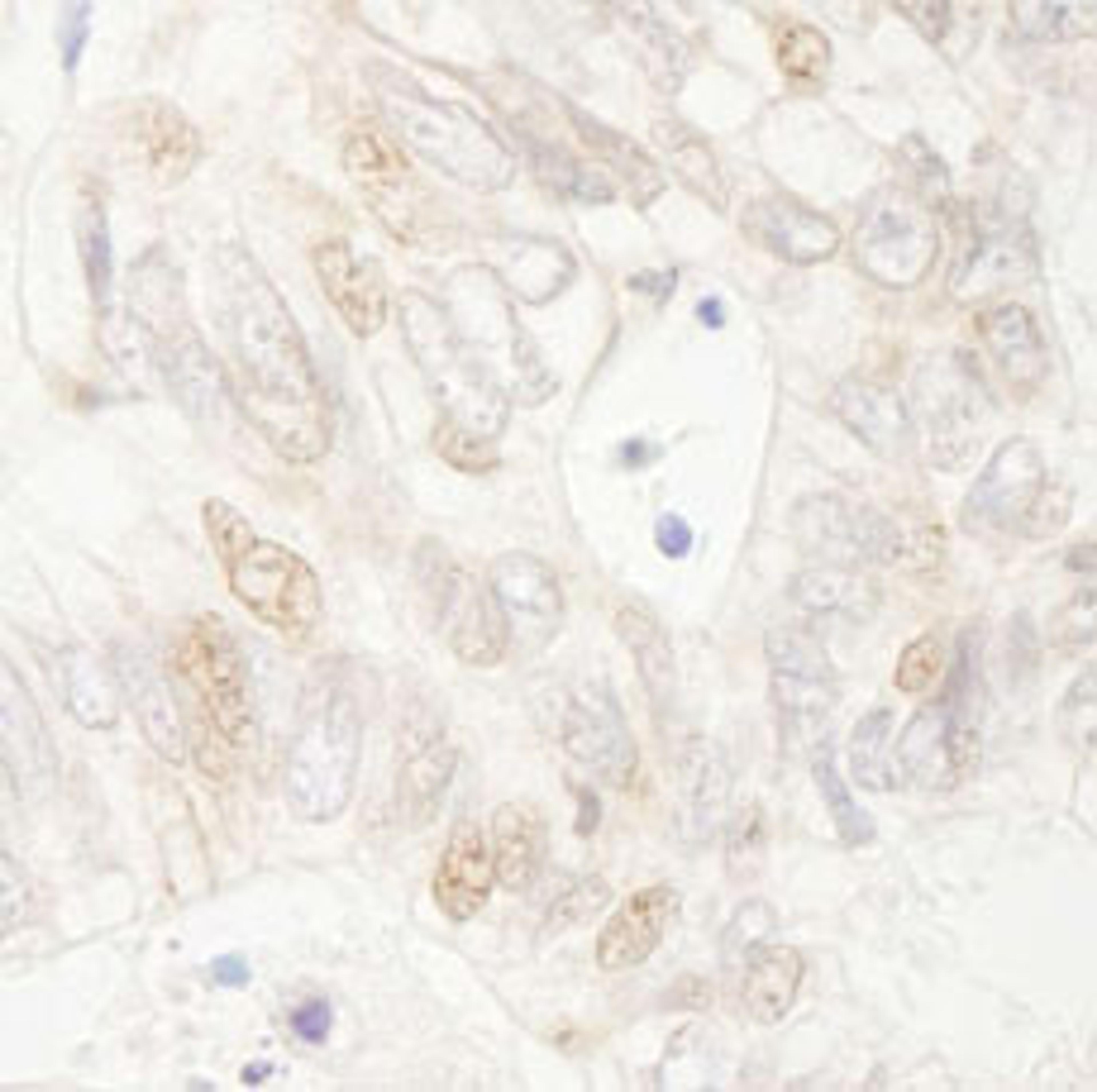 Detection of human APC by immunohistochemistry.