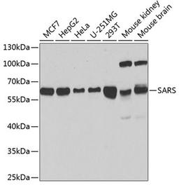 Western blot - SARS antibody (A13350)