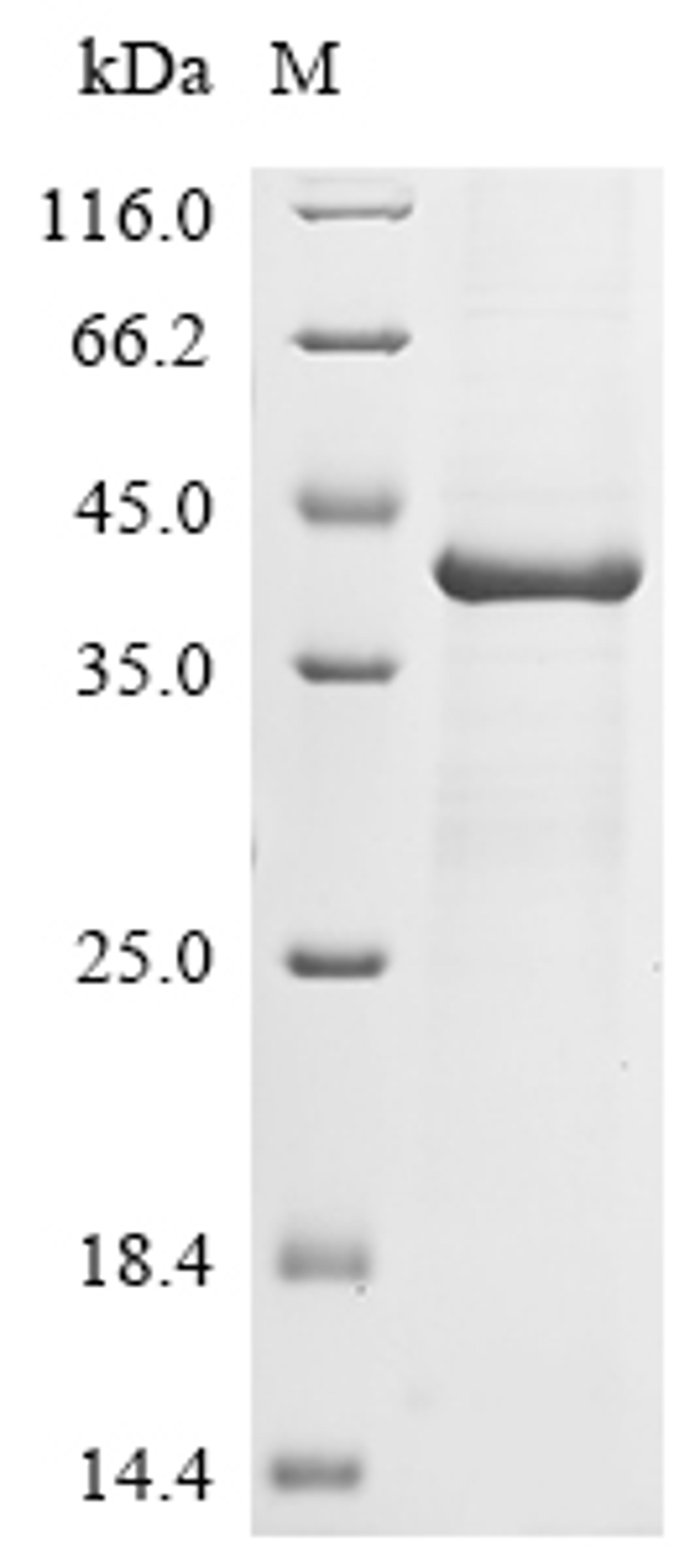 (Tris-Glycine gel) Discontinuous SDS-PAGE (reduced) with 5% enrichment gel and 15% separation gel.