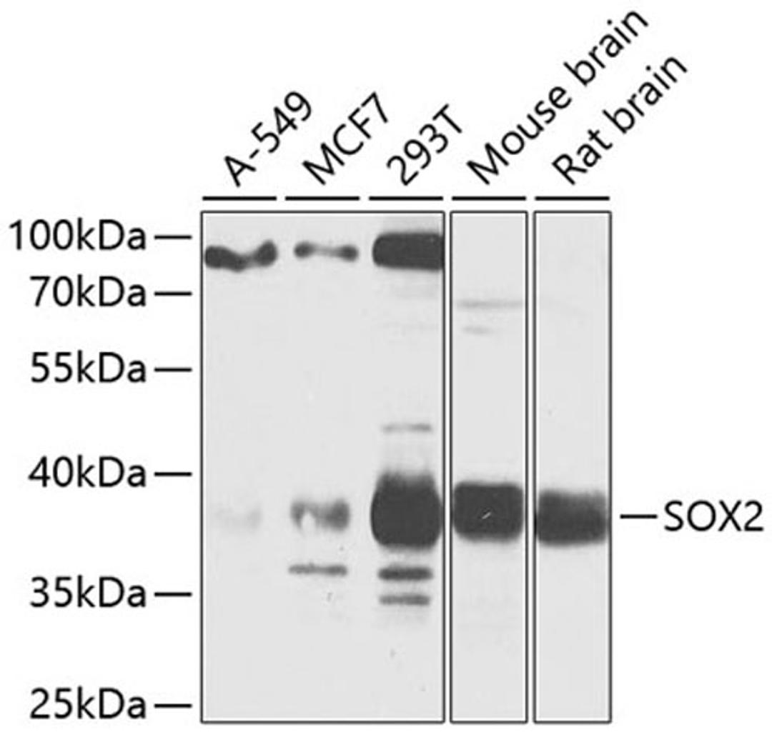 Western blot - SOX2 antibody (A11501)