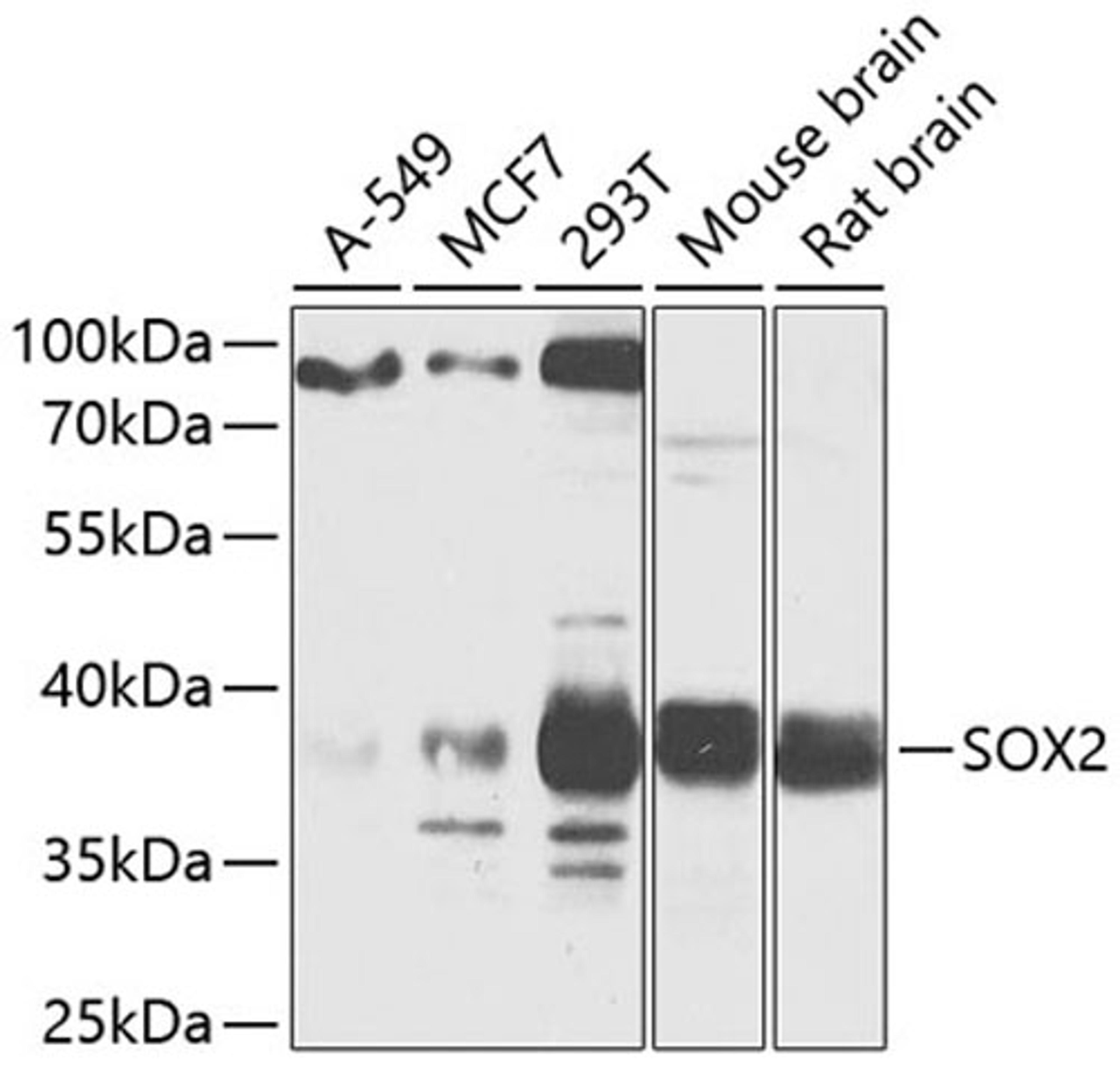 Western blot - SOX2 antibody (A11501)