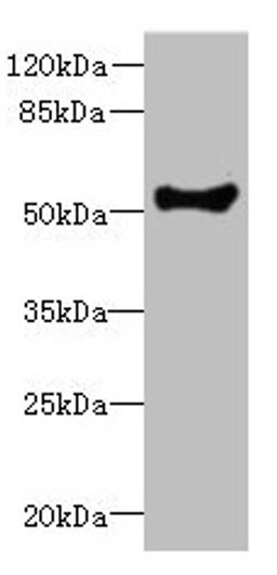 Western blot. All lanes: COCH antibody at 1.73µg/ml + Human placenta tissue. Secondary. Goat polyclonal to rabbit IgG at 1/10000 dilution. Predicted band size: 60, 54 kDa. Observed band size: 54 kDa