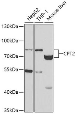 Western blot - CPT2 antibody (A2876)