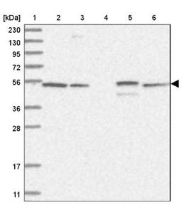 Western Blot: RSPH4A Antibody [NBP1-90573] - Lane 1: Marker [kDa] 230, 130, 95, 72, 56, 36, 28, 17, 11<br/>Lane 2: Human cell line RT-4<br/>Lane 3: Human cell line U-251MG sp<br/>Lane 4: Human plasma (IgG/HSA depleted)<br/>Lane 5: Human liver tissue<br/>Lane 6: Human tonsil tissue