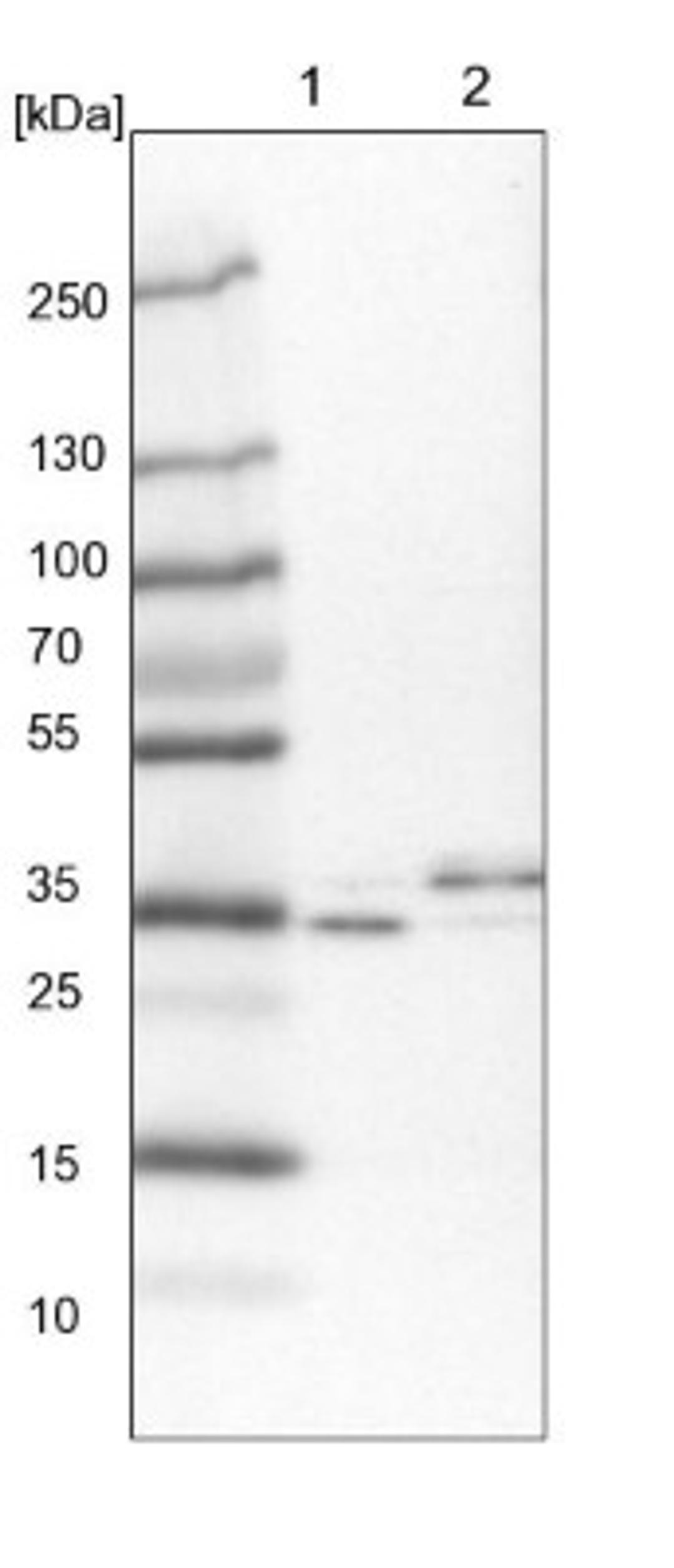 Western Blot: LRRC39 Antibody [NBP1-81198] - Lane 1: NIH-3T3 cell lysate (Mouse embryonic fibroblast cells)<br/>Lane 2: NBT-II cell lysate (Rat Wistar bladder tumour cells)