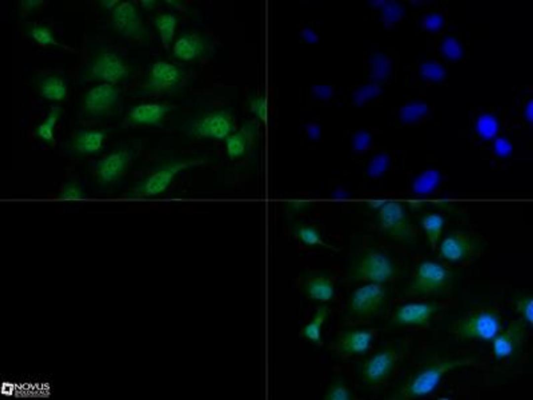 Immunocytochemistry/Immunofluorescence: HDAC3 Antibody [NB100-1669] - HDAC3 antibody was tested in HeLa cells with Dylight 488 (green). Nuclei were counterstained with DAPI (blue). An antibody dilution of 1:10 was used. Image objective 40x.