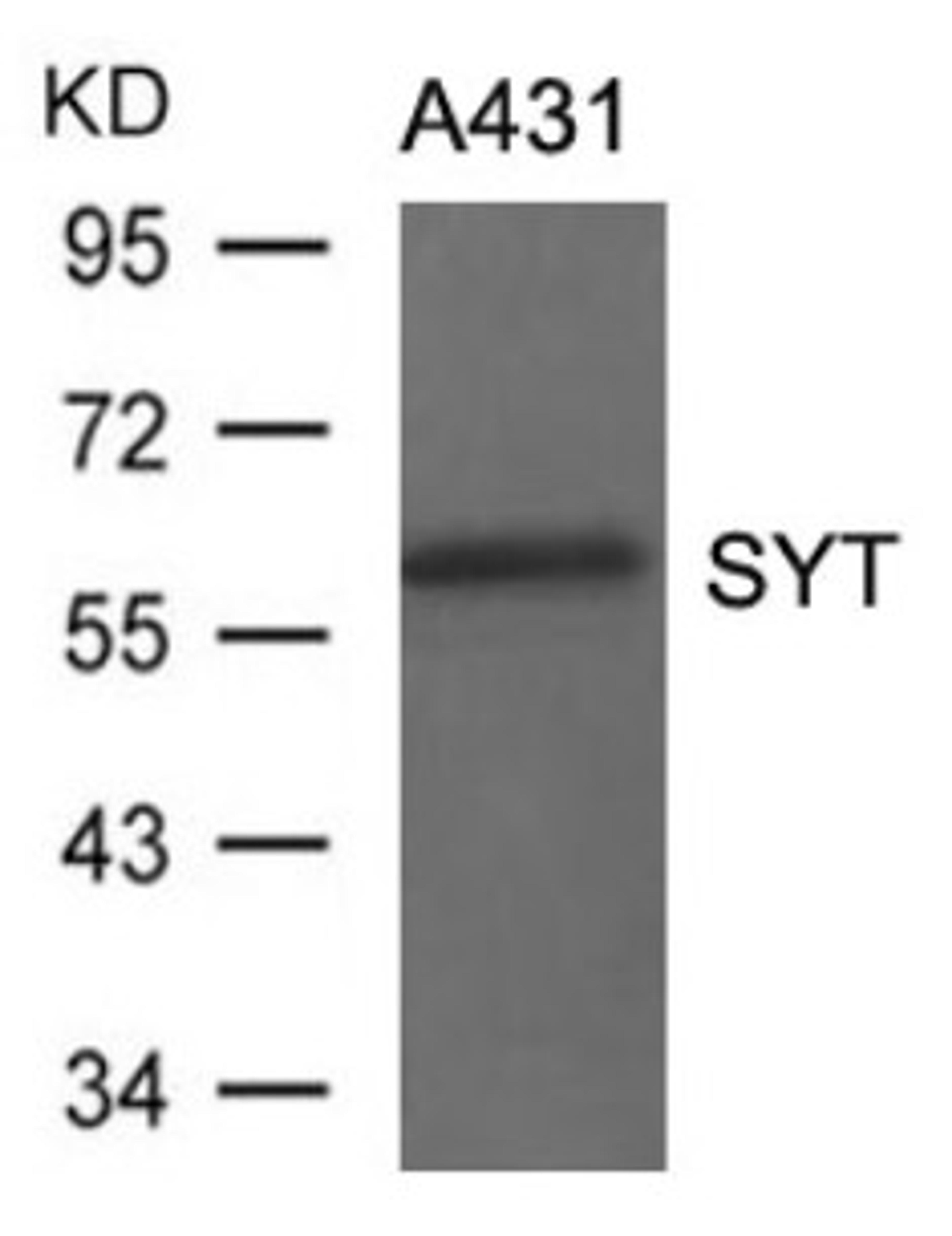 Western blot analysis of lysed extracts from A431 cells using SYT Antibody.