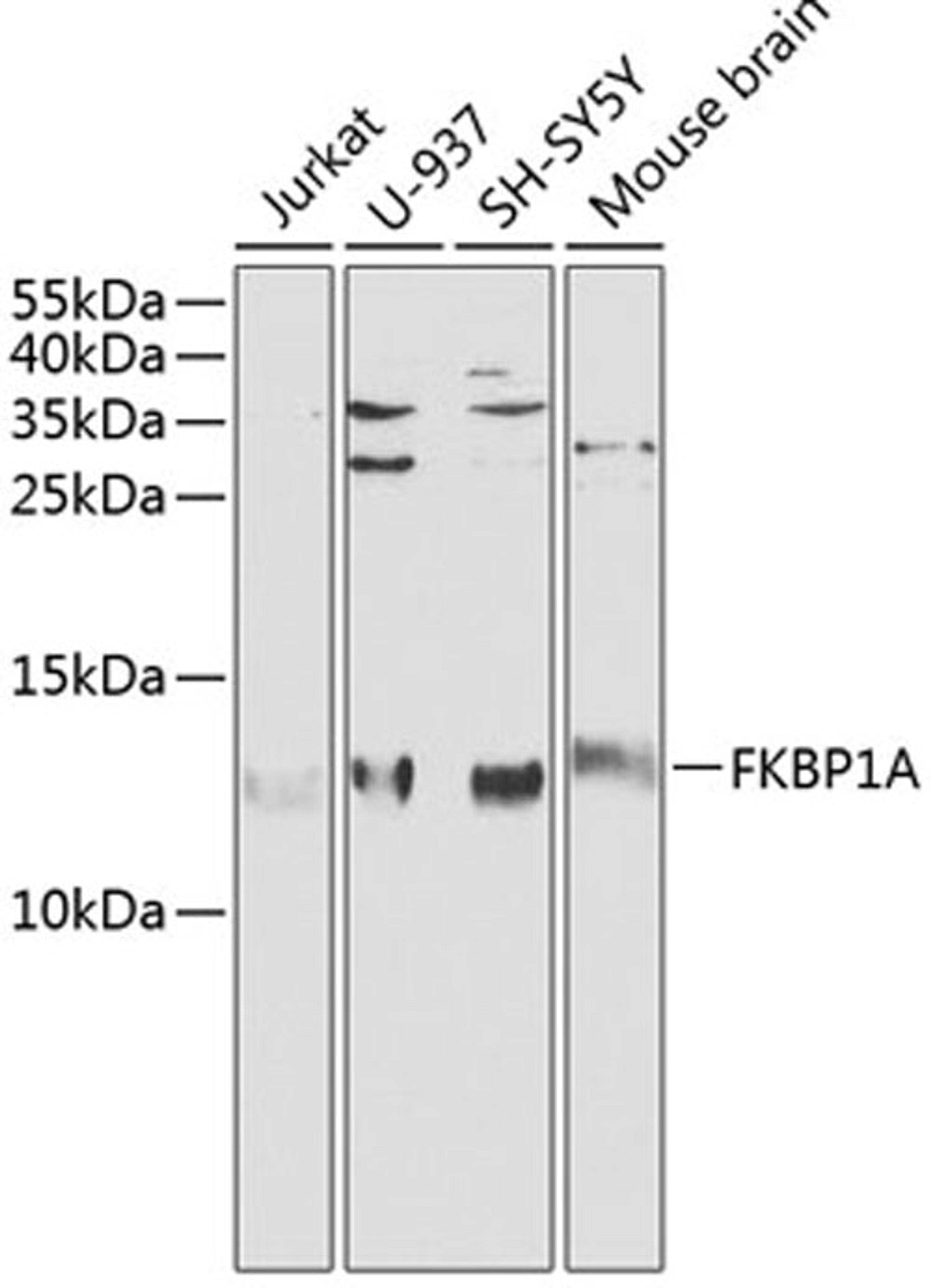 Western blot - FKBP1A antibody (A1763)