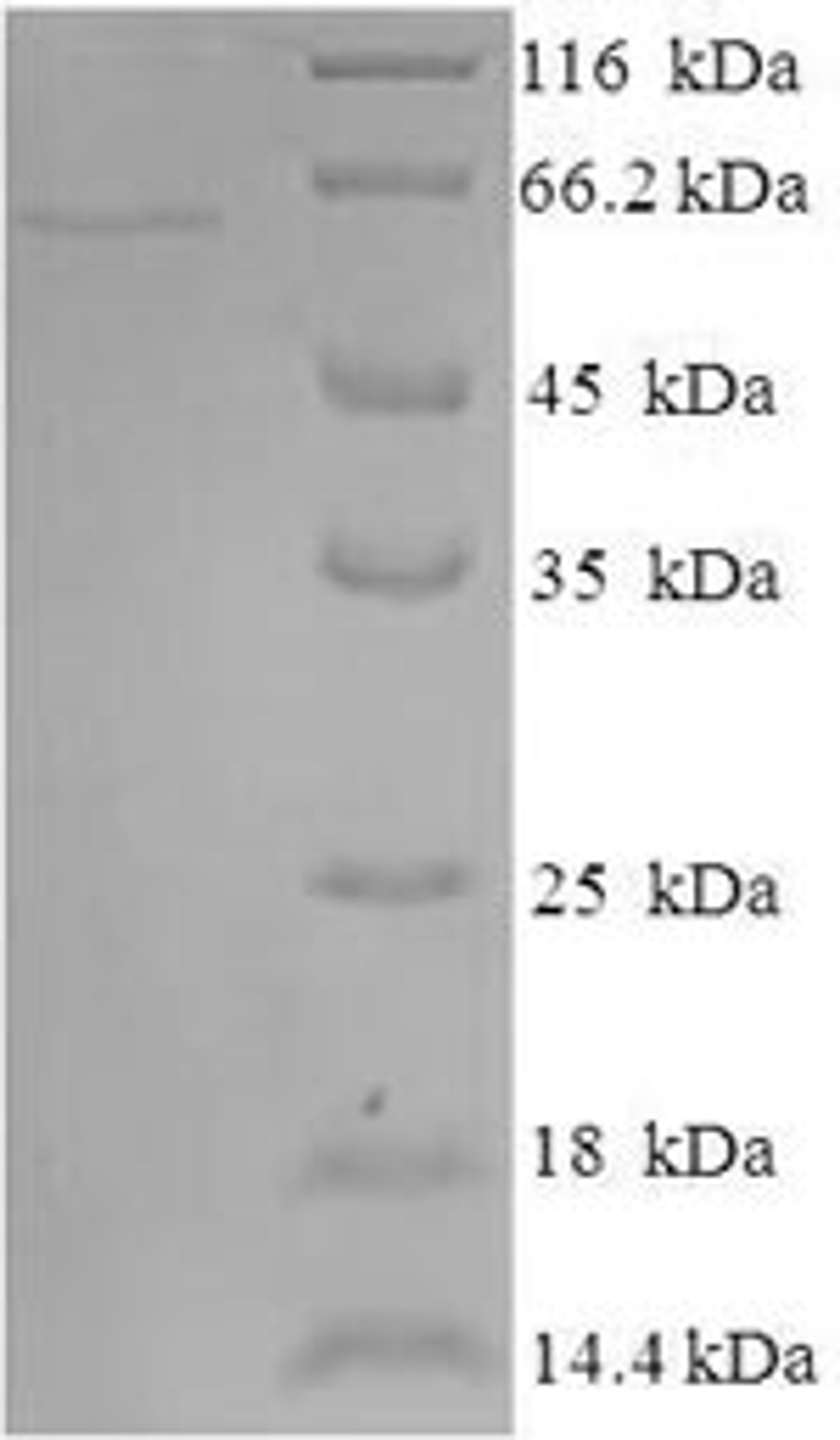 (Tris-Glycine gel) Discontinuous SDS-PAGE (reduced) with 5% enrichment gel and 15% separation gel.