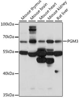 Western blot - PGM3 antibody (A15698)