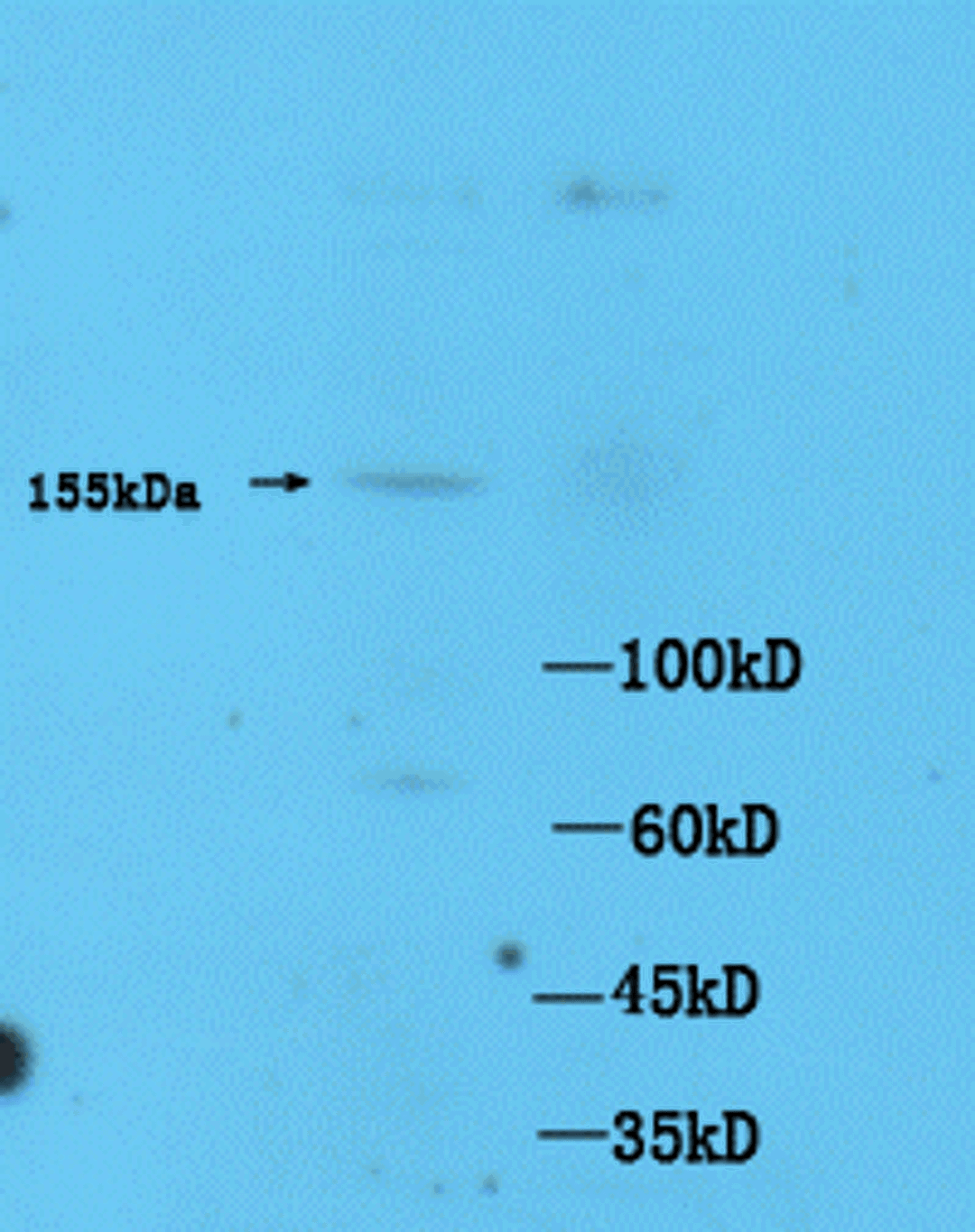 Western blot of mouse brain tissue using ASK1 (phospho-Thr845) antibody.