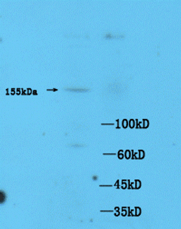 Western blot of mouse brain tissue using ASK1 (phospho-Thr845) antibody.