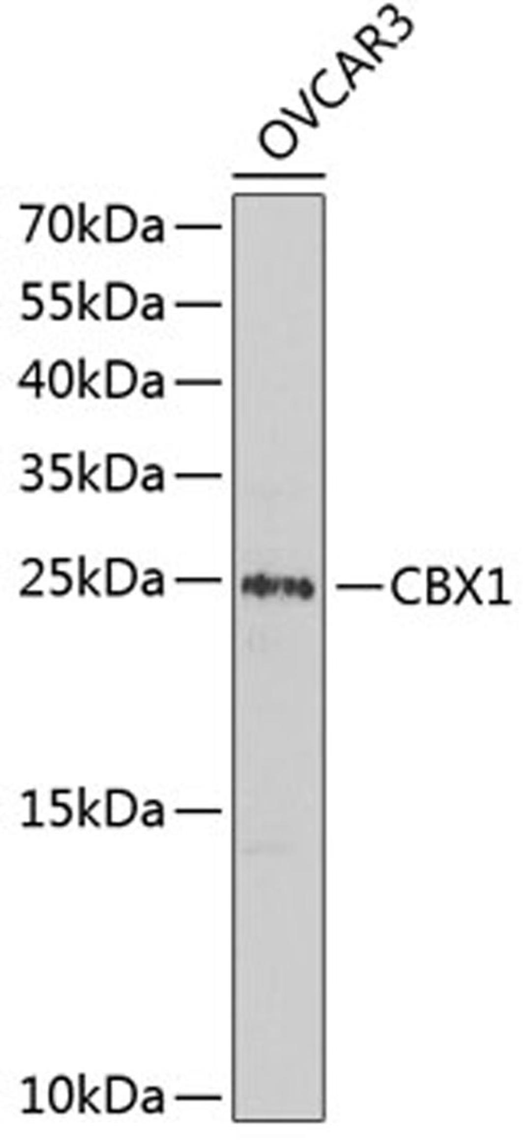 Western blot - CBX1 antibody (A2247)