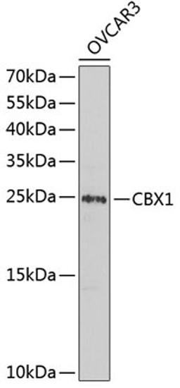 Western blot - CBX1 antibody (A2247)