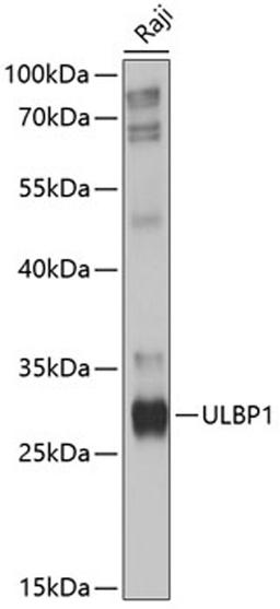 Western blot - ULBP1 antibody (A10483)