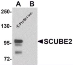 Western blot analysis of SCUBE2 in Daudi cell lysate with SCUBE2 antibody at 1 &#956;g/mL in (A) the absence and (B) the presence of blocking peptide.