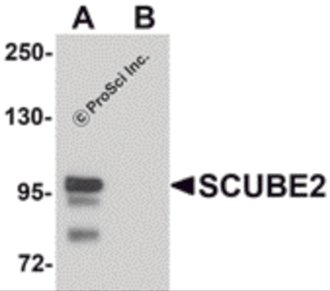 Western blot analysis of SCUBE2 in Daudi cell lysate with SCUBE2 antibody at 1 μg/mL in (A) the absence and (B) the presence of blocking peptide.