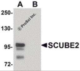 Western blot analysis of SCUBE2 in Daudi cell lysate with SCUBE2 antibody at 1 μg/mL in (A) the absence and (B) the presence of blocking peptide.