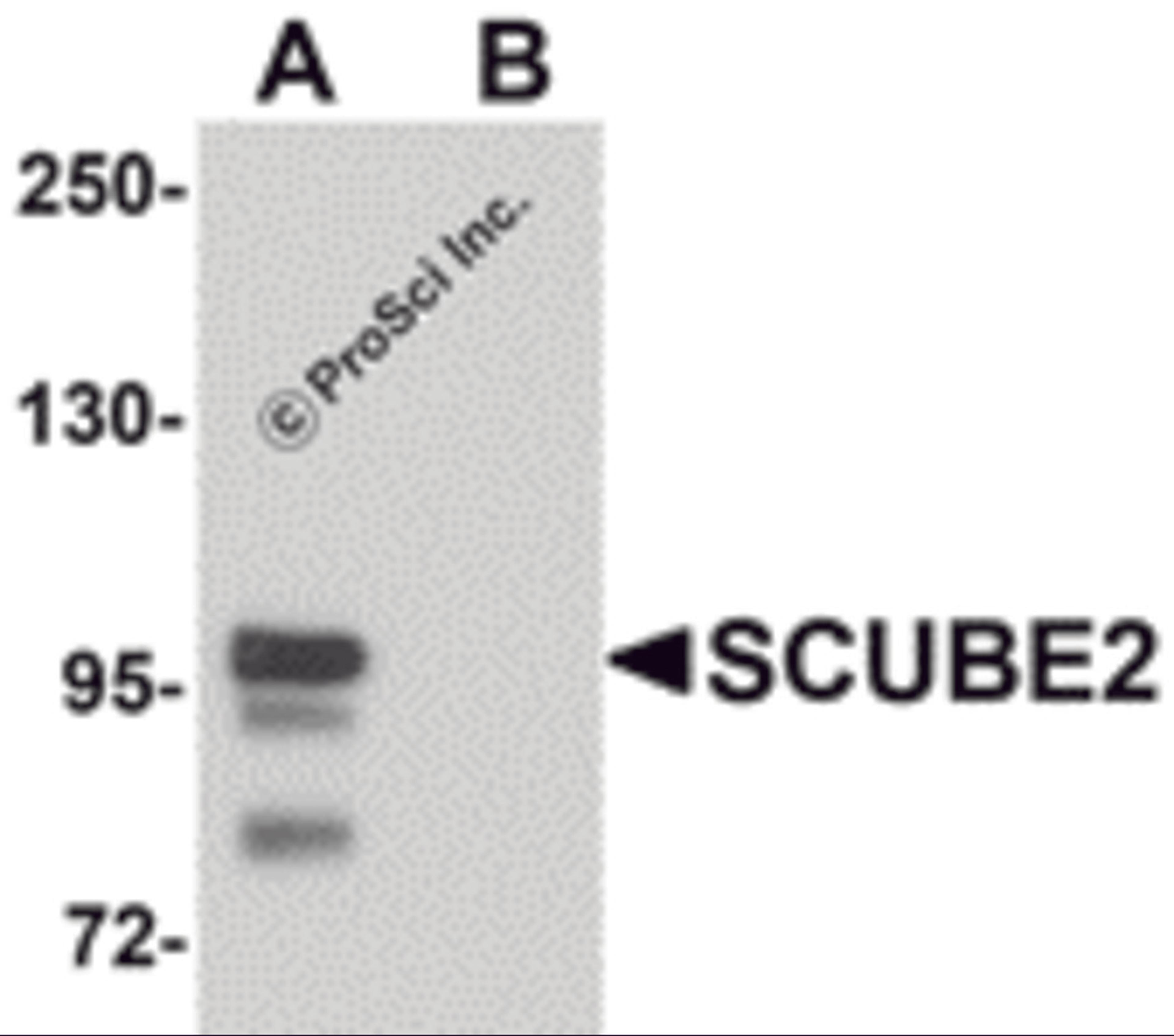 Western blot analysis of SCUBE2 in Daudi cell lysate with SCUBE2 antibody at 1 μg/mL in (A) the absence and (B) the presence of blocking peptide.