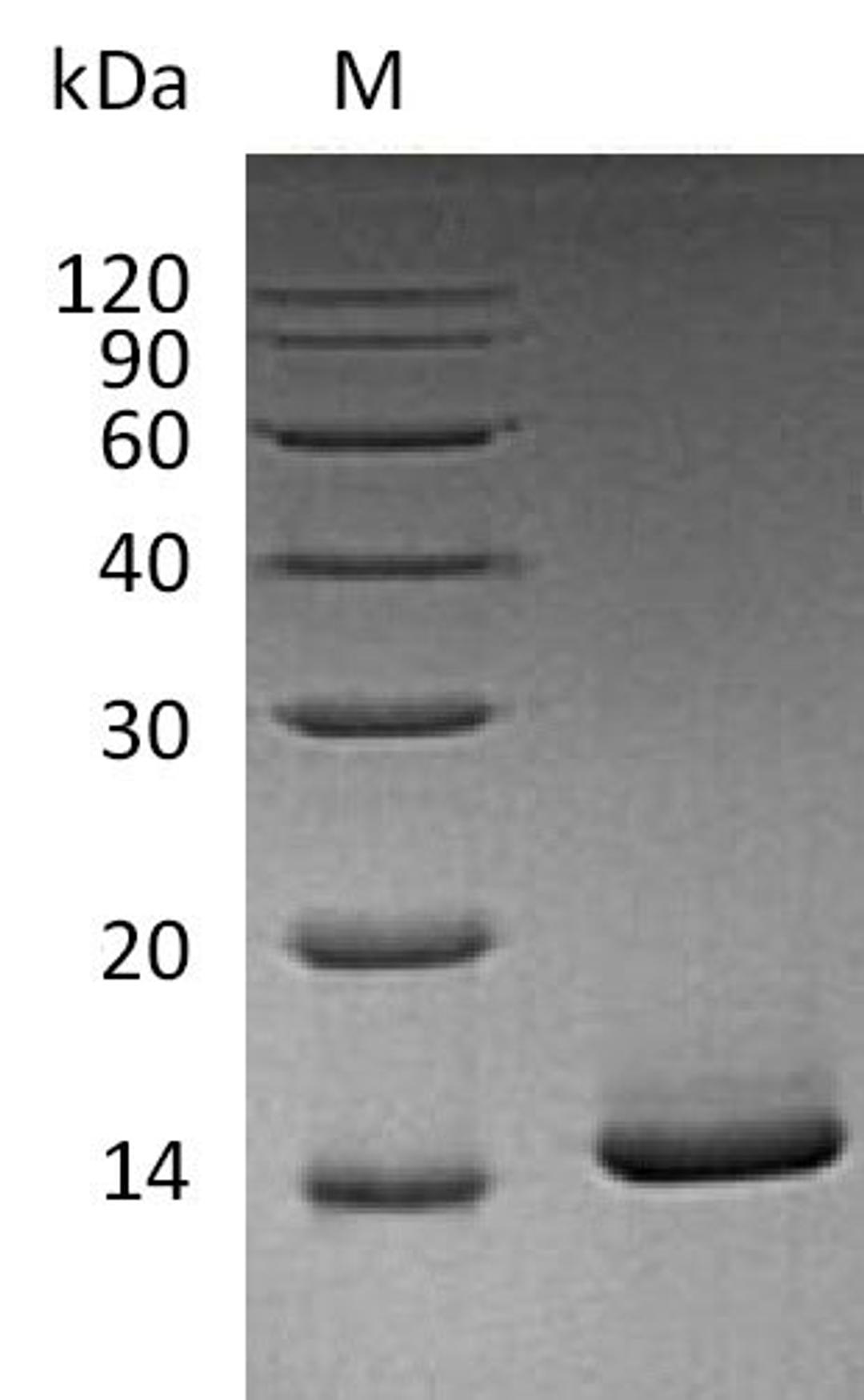 (Tris-Glycine gel) Discontinuous SDS-PAGE (reduced) with 5% enrichment gel and 15% separation gel.