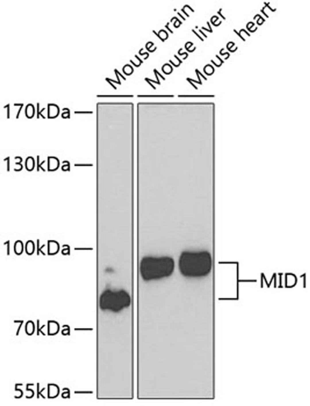 Western blot - MID1 antibody (A7291)