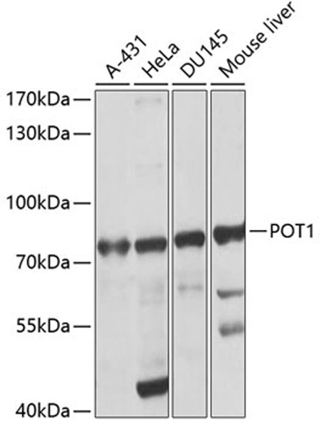 Western blot - POT1 antibody (A1491)